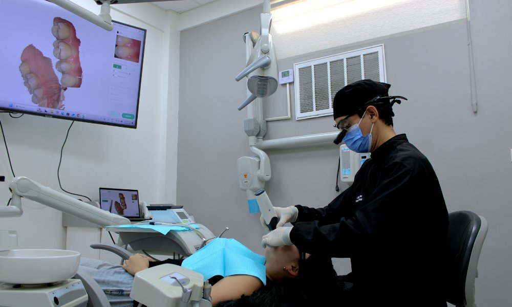 Escáner Intraoral 3D